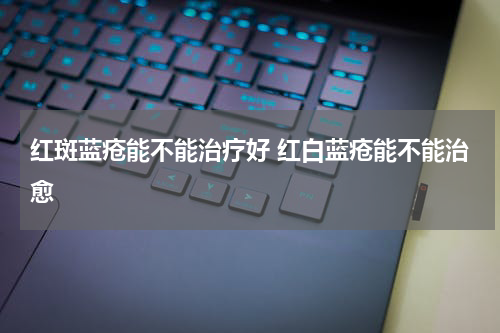 红斑蓝疮能不能治疗好 红白蓝疮能不能治愈