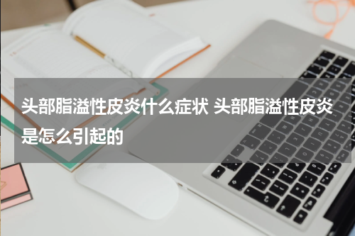 头部脂溢性皮炎什么症状 头部脂溢性皮炎是怎么引起的