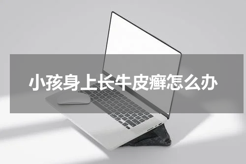 小孩身上长牛皮癣怎么办