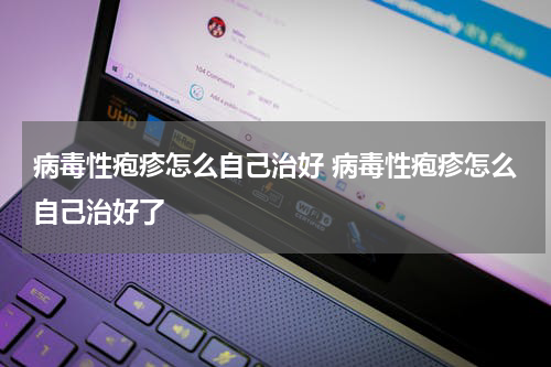 病毒性疱疹怎么自己治好 病毒性疱疹怎么自己治好了