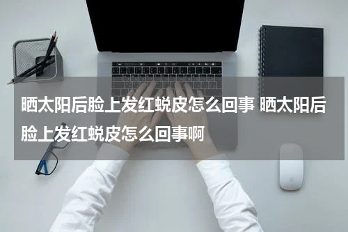 晒太阳后脸上发红蜕皮怎么回事 晒太阳后脸上发红蜕皮怎么回事啊