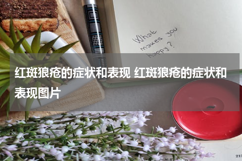 红斑狼疮的症状和表现 红斑狼疮的症状和表现图片