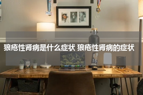 狼疮性肾病是什么症状 狼疮性肾病的症状