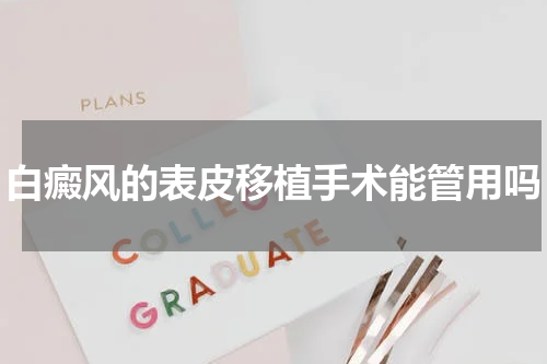 白癜风的表皮移植手术能管用吗