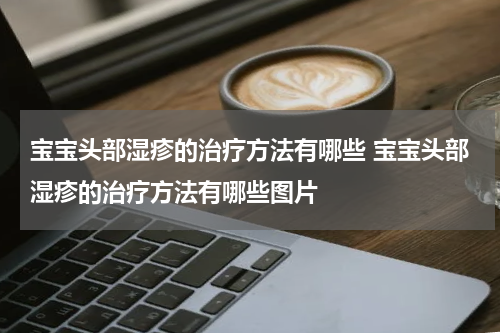 宝宝头部湿疹的治疗方法有哪些 宝宝头部湿疹的治疗方法有哪些图片