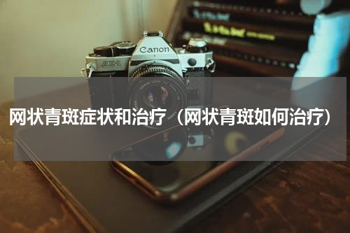 网状青斑症状和治疗（网状青斑如何治疗）