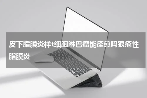 皮下脂膜炎样t细胞淋巴瘤能痊愈吗狼疮性脂膜炎