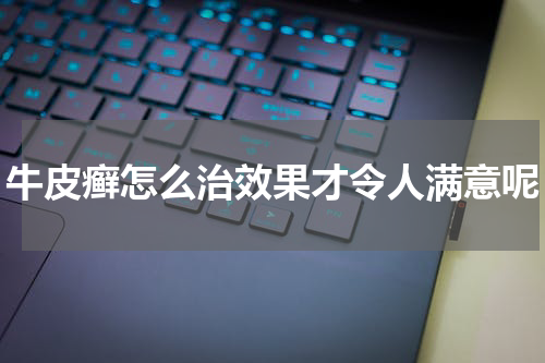 牛皮癣怎么治效果才令人满意呢
