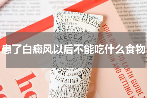 患了白癜风以后不能吃什么食物