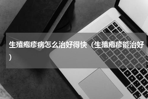 生殖疱疹病怎么治好得快（生殖疱疹能治好）