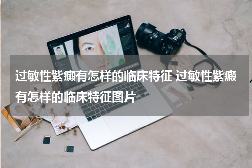 过敏性紫癜有怎样的临床特征 过敏性紫癜有怎样的临床特征图片