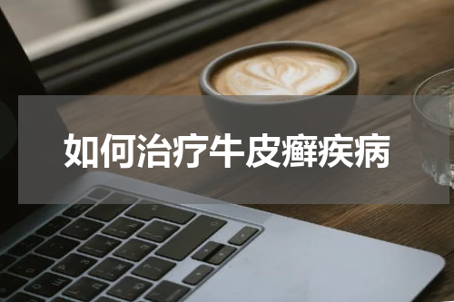 如何治疗牛皮癣疾病