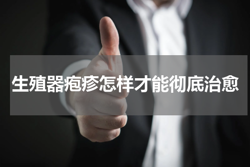 生殖器疱疹怎样才能彻底治愈
