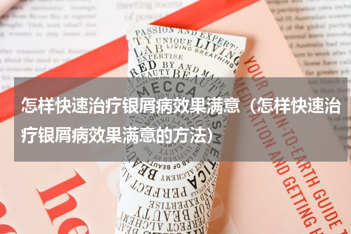 怎样快速治疗银屑病效果满意（怎样快速治疗银屑病效果满意的方法）