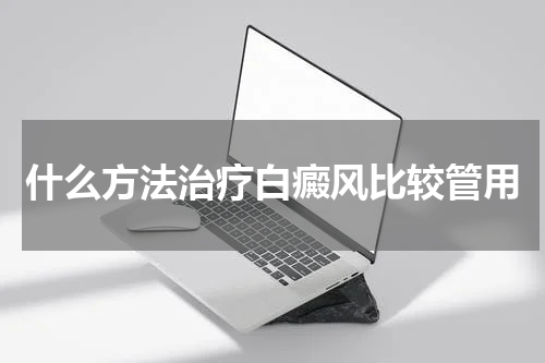 什么方法治疗白癜风比较管用