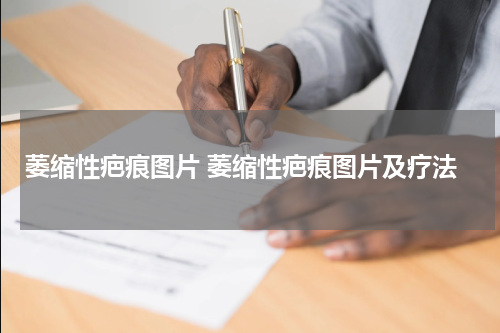 萎缩性疤痕图片 萎缩性疤痕图片及疗法