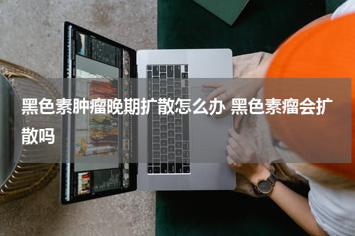黑色素肿瘤晚期扩散怎么办 黑色素瘤会扩散吗