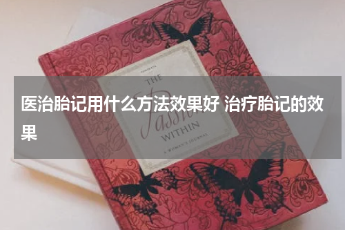医治胎记用什么方法效果好 治疗胎记的效果