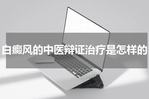 白癜风的中医辩证治疗是怎样的