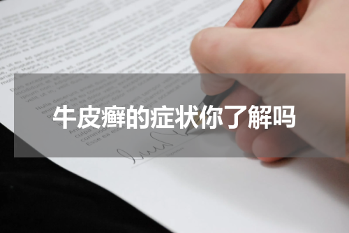 牛皮癣的症状你了解吗