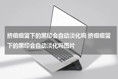 挤痘痘留下的黑印会自动淡化吗 挤痘痘留下的黑印会自动淡化吗图片