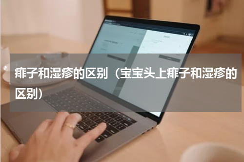 痱子和湿疹的区别（宝宝头上痱子和湿疹的区别）