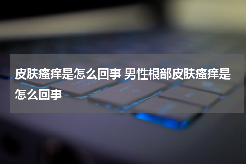 皮肤瘙痒是怎么回事 男性根部皮肤瘙痒是怎么回事