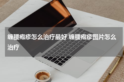 缠腰疱疹怎么治疗最好 缠腰疱疹图片怎么治疗