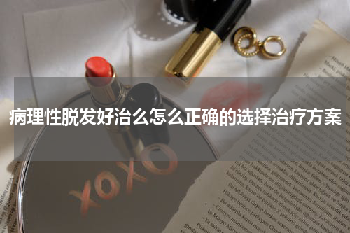 病理性脱发好治么怎么正确的选择治疗方案