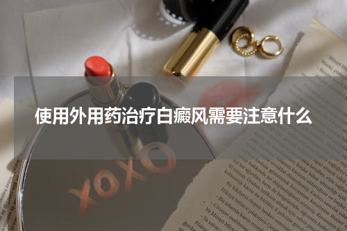 使用外用药治疗白癜风需要注意什么