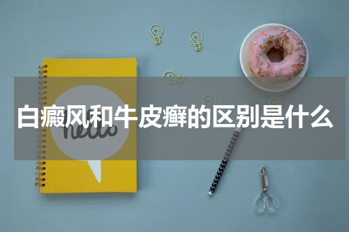 白癜风和牛皮癣的区别是什么