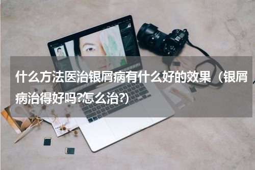 什么方法医治银屑病有什么好的效果（银屑病治得好吗?怎么治?）