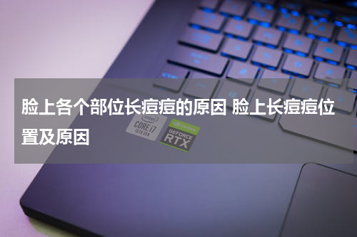 脸上各个部位长痘痘的原因 脸上长痘痘位置及原因