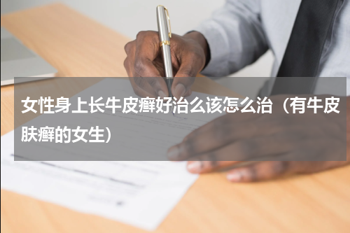 女性身上长牛皮癣好治么该怎么治（有牛皮肤癣的女生）