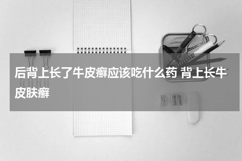 后背上长了牛皮癣应该吃什么药 背上长牛皮肤癣