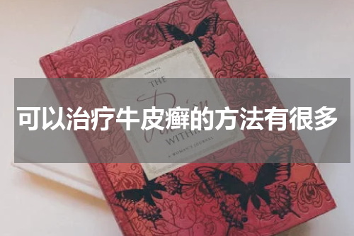 可以治疗牛皮癣的方法有很多