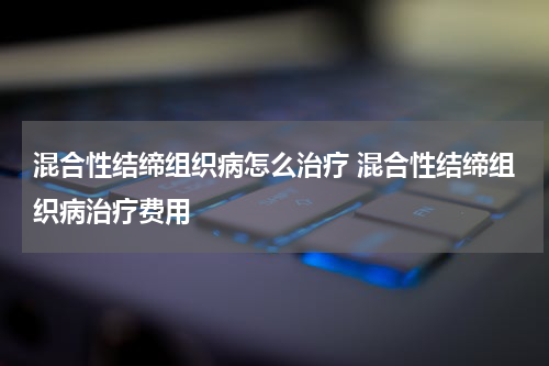 混合性结缔组织病怎么治疗 混合性结缔组织病治疗费用