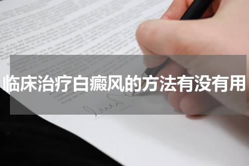 临床治疗白癜风的方法有没有用