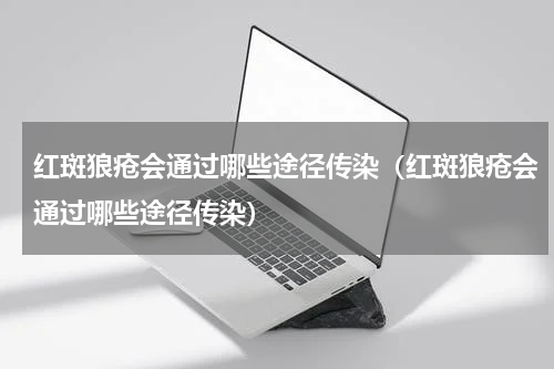 红斑狼疮会通过哪些途径传染（红斑狼疮会通过哪些途径传染）