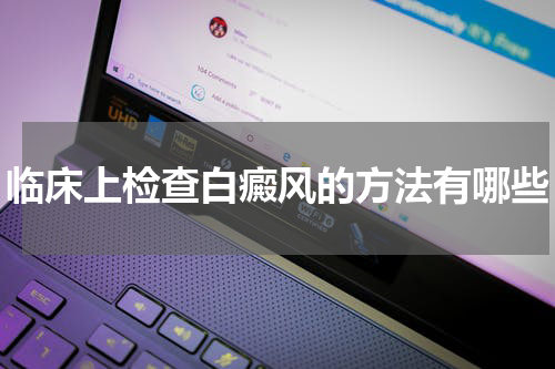 临床上检查白癜风的方法有哪些