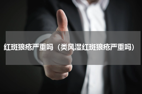 红斑狼疮严重吗（类风湿红斑狼疮严重吗）