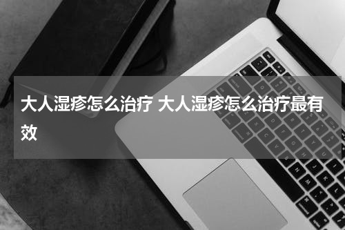大人湿疹怎么治疗 大人湿疹怎么治疗最有效