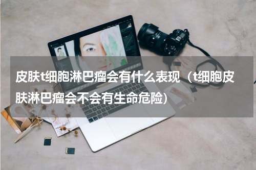皮肤t细胞淋巴瘤会有什么表现（t细胞皮肤淋巴瘤会不会有生命危险）