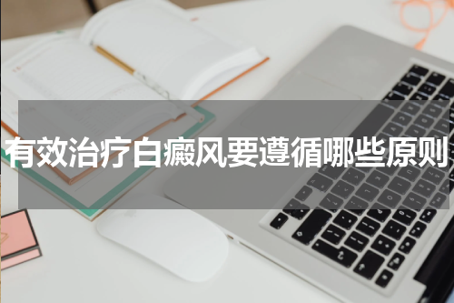 有效治疗白癜风要遵循哪些原则
