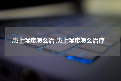 患上湿疹怎么治 患上湿疹怎么治疗