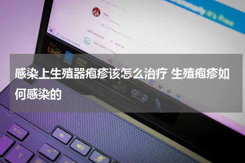 感染上生殖器疱疹该怎么治疗 生殖疱疹如何感染的