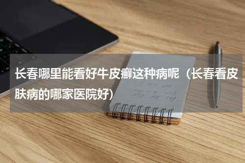 长春哪里能看好牛皮癣这种病呢（长春看皮肤病的哪家医院好）