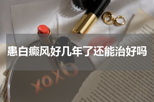 患白癜风好几年了还能治好吗