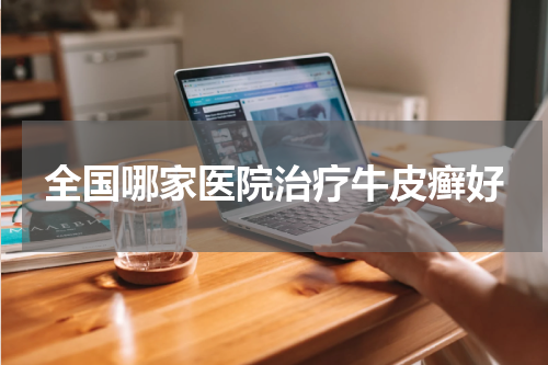 全国哪家医院治疗牛皮癣好