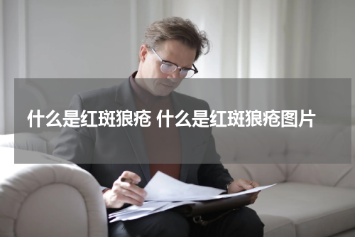 什么是红斑狼疮 什么是红斑狼疮图片